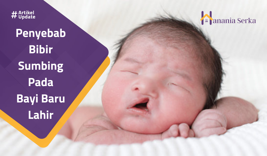You are currently viewing Penyebab Bibir Sumbing Pada Bayi Baru Lahir