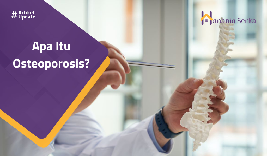 You are currently viewing Apa Itu Osteoporosis?