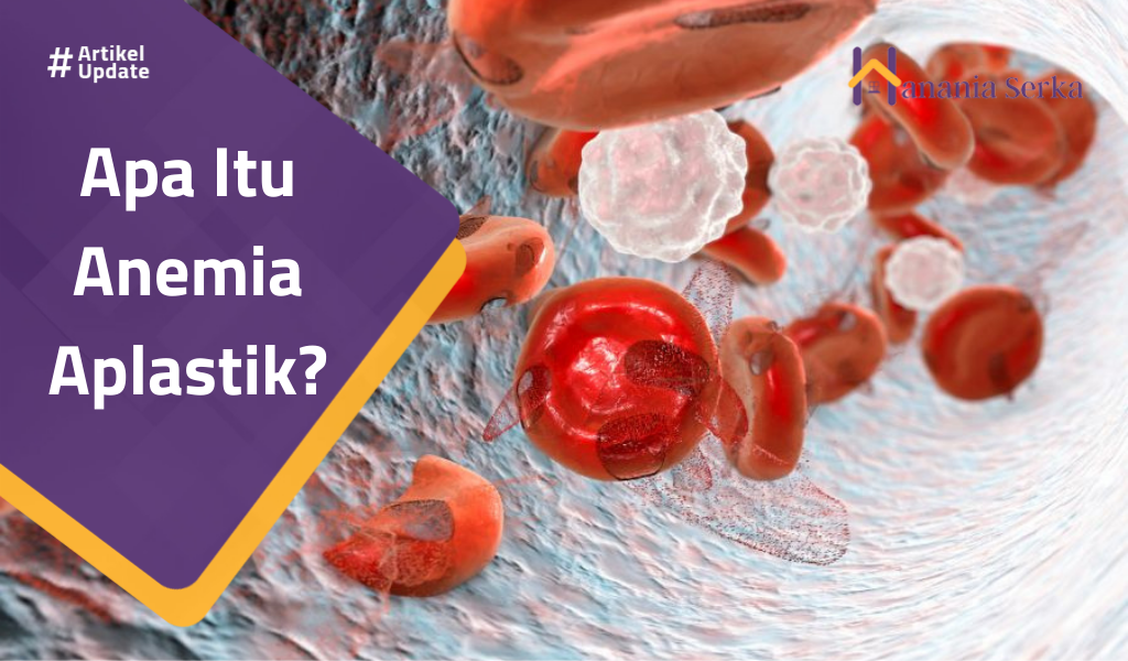 You are currently viewing Apa Itu Anemia Aplastik?