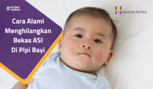 Read more about the article Cara Alami Menghilangkan Bekas ASI Di Pipi Bayi