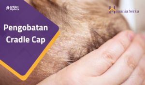 Read more about the article Pengobatan Cradle Cap