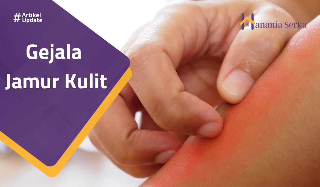 You are currently viewing Gejala Jamur Kulit