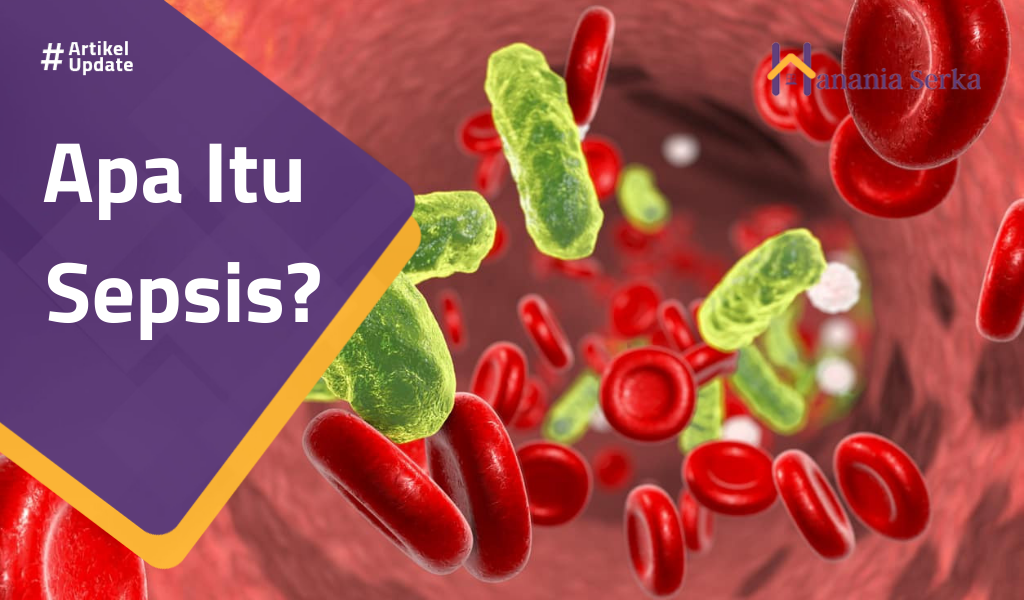 You are currently viewing Apa Itu Sepsis?
