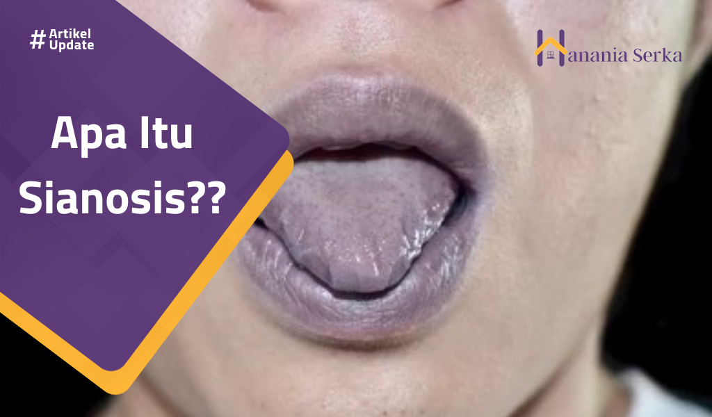 You are currently viewing Apa Itu Sianosis??