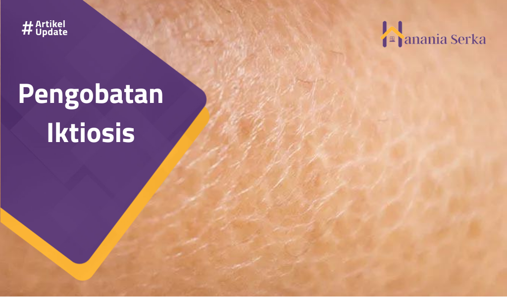 Read more about the article Pengobatan Iktiosis