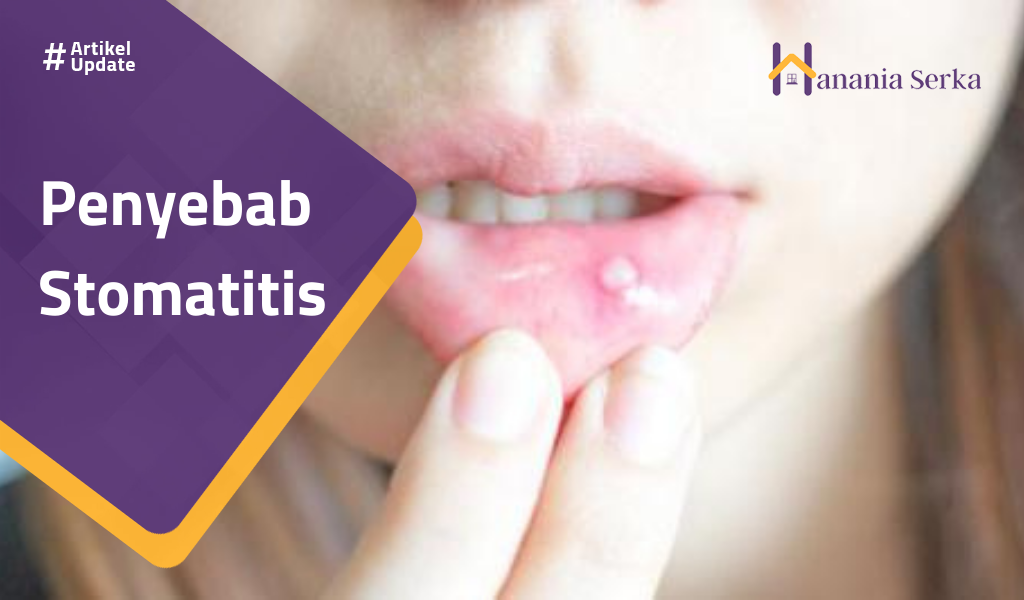 Read more about the article Penyebab Stomatitis