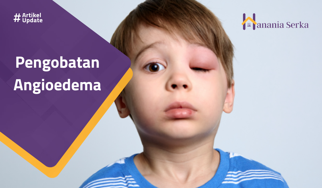 You are currently viewing Pengobatan Angioedema