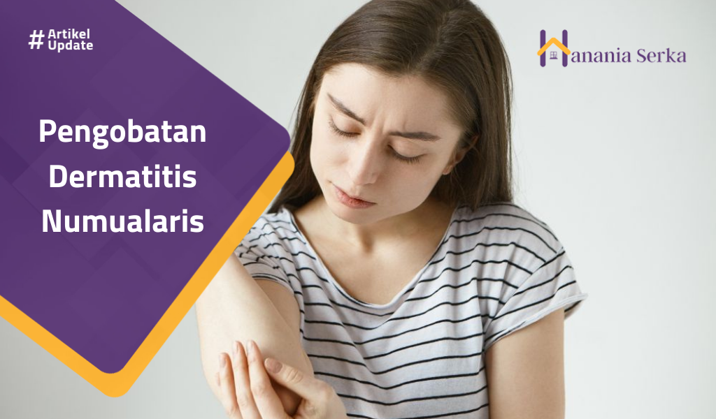 Read more about the article Pengobatan Dermatitis Numularis