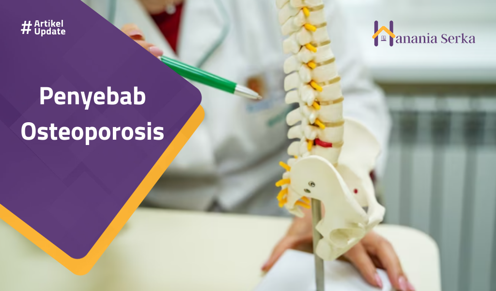 Read more about the article Penyebab Osteoporosis