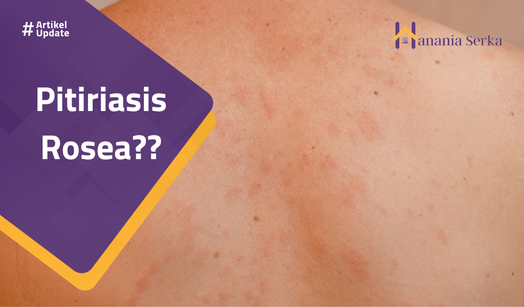 You are currently viewing Pitiriasis Rosea??