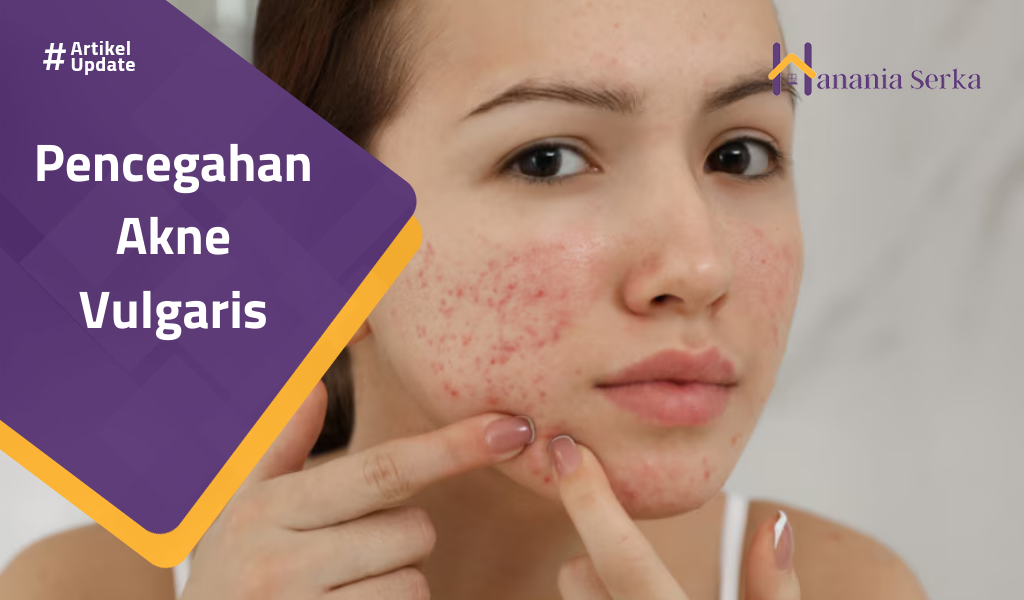 Read more about the article Pencegahan Akne Vulgaris