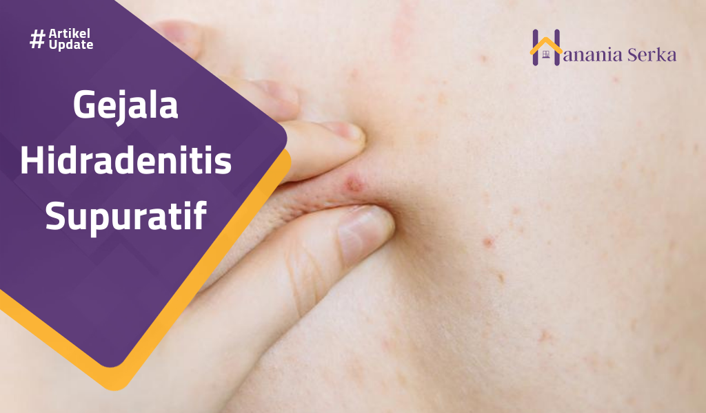 You are currently viewing Gejala Hidradenitis Supuratif