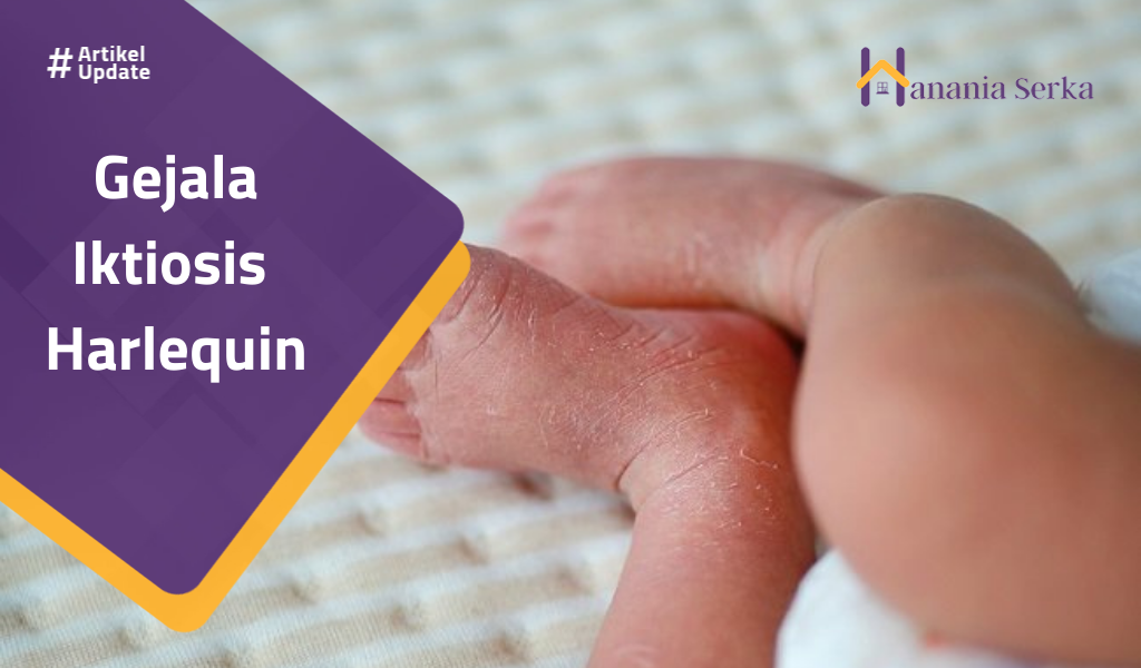 You are currently viewing Gejala Iktiosis Harlequin