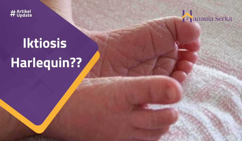 Read more about the article Iktiosis  Harlequin??