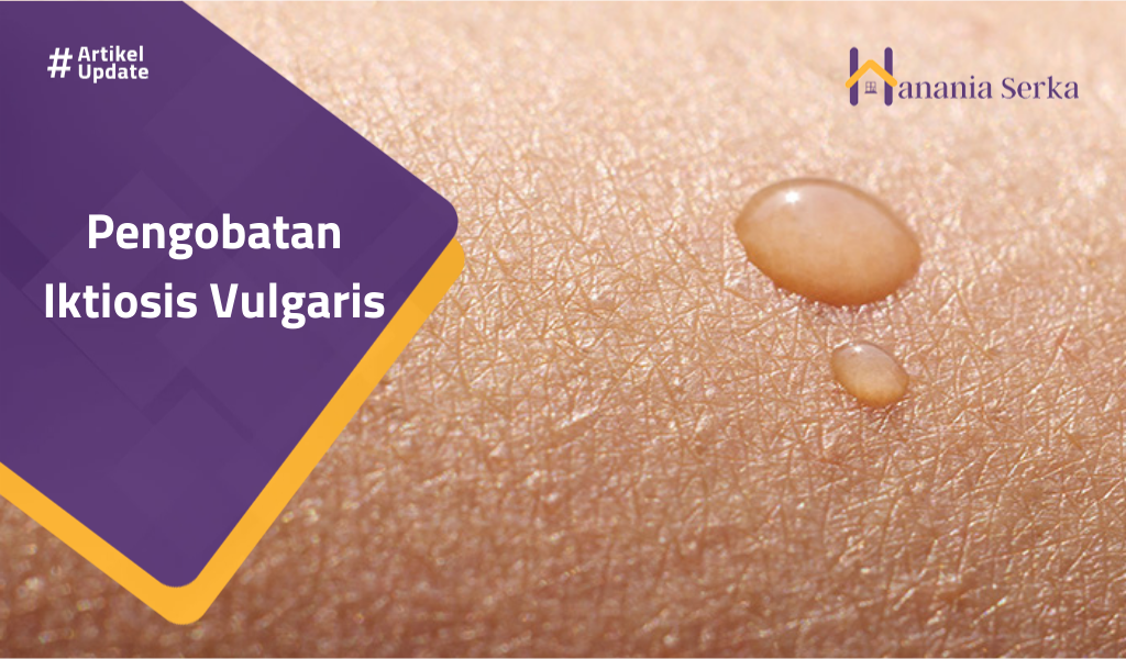 Read more about the article Pengobatan Iktiosis Vulgaris