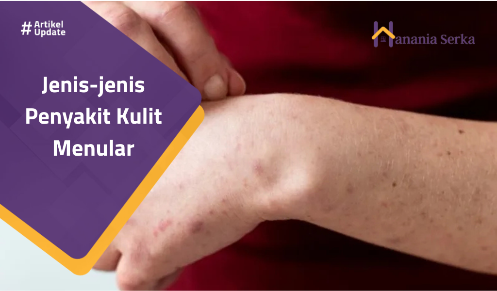 You are currently viewing Jenis-jenis Penyakit Kulit Menular