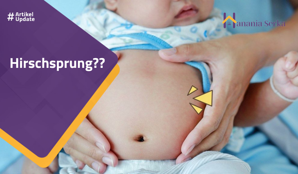 You are currently viewing Hirschsprung??