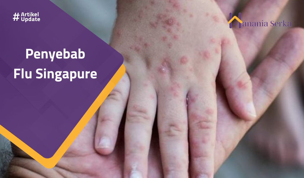 You are currently viewing Penyebab Flu Singapure