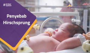 Read more about the article Penyebab Hirschsprung