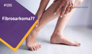 Read more about the article Fibrosarkoma??