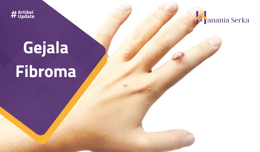 You are currently viewing Gejala Fibroma