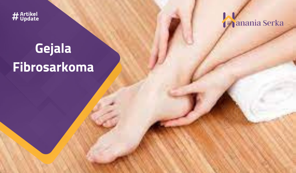 You are currently viewing Gejala Fibrosarkoma