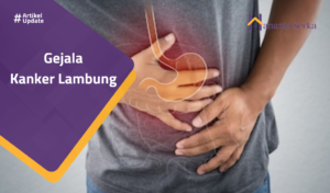 Read more about the article Gejala Kanker Lambung