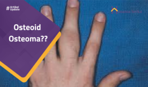 Read more about the article Osteoid Osteoma??