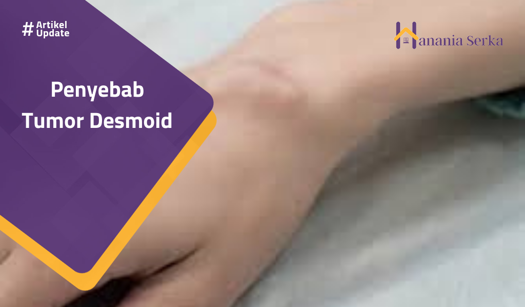 You are currently viewing Penyebab Tumor Desmoid