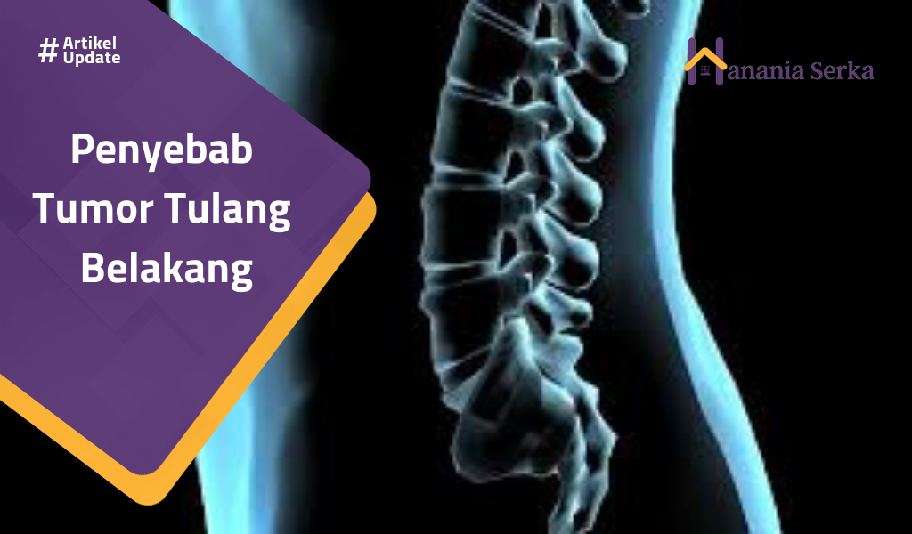You are currently viewing Penyebab Tumor Tulang Belakang