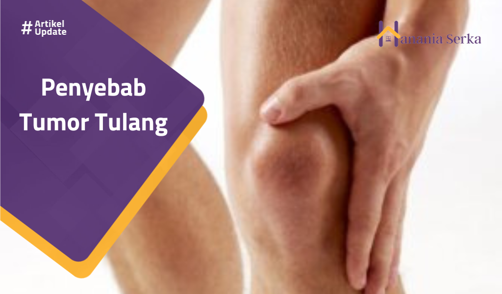 You are currently viewing Penyebab Tumor Tulang
