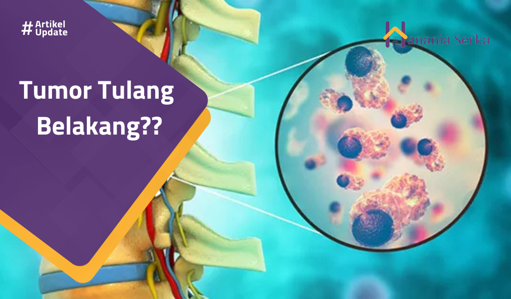 Read more about the article Tumor Tulang Belakang??