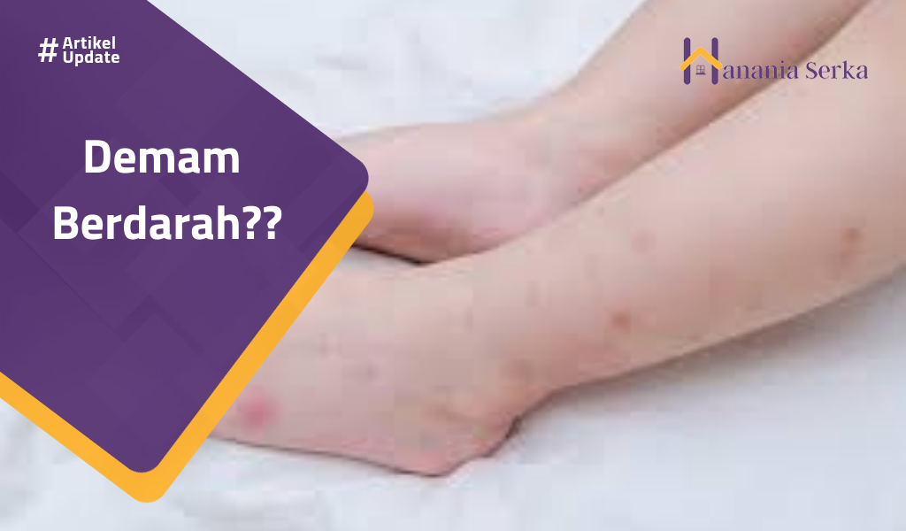 You are currently viewing Demam Berdarah??