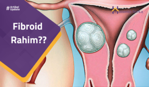 Read more about the article Fibroid Rahim??