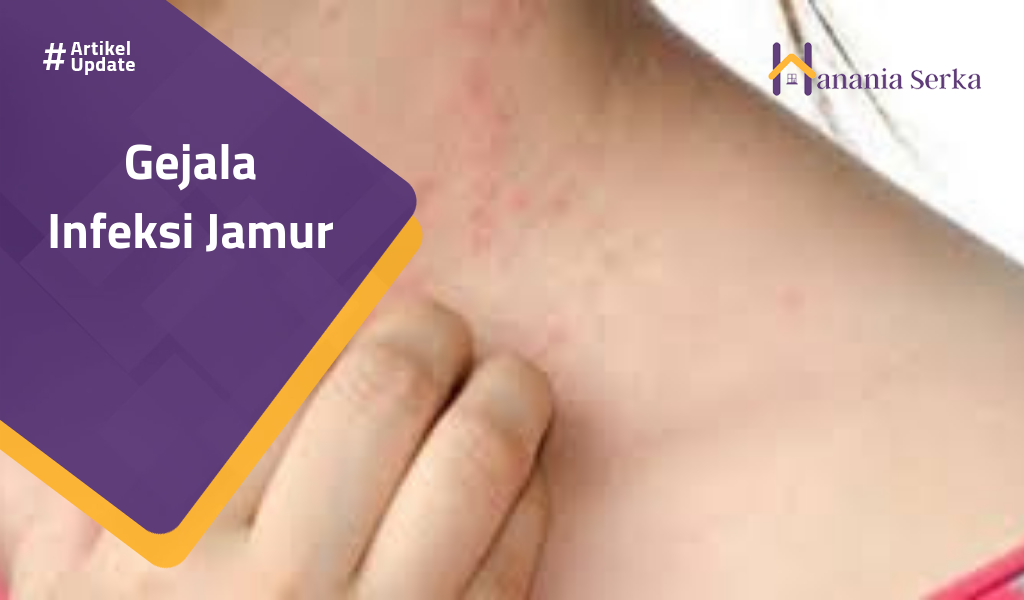 You are currently viewing Gejala Infeksi Jamur