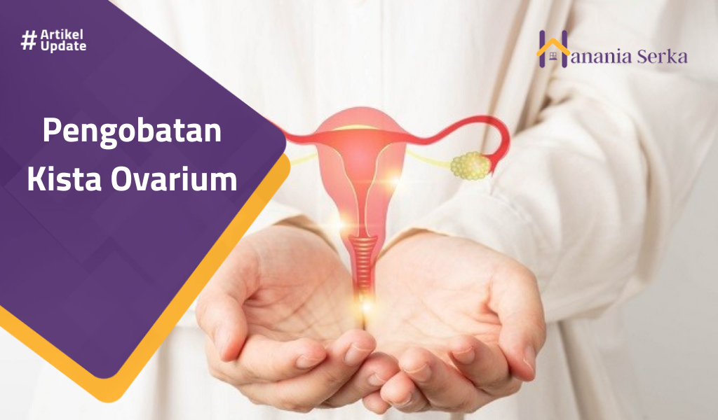 Read more about the article Pengobatan Kista Ovarium