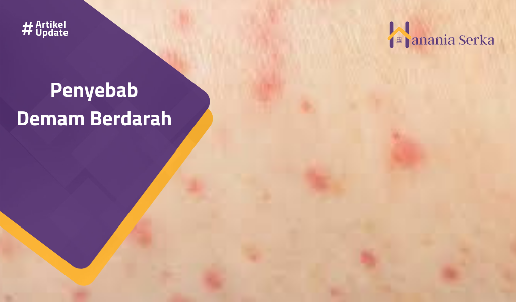 You are currently viewing Penyebab Demam Berdarah