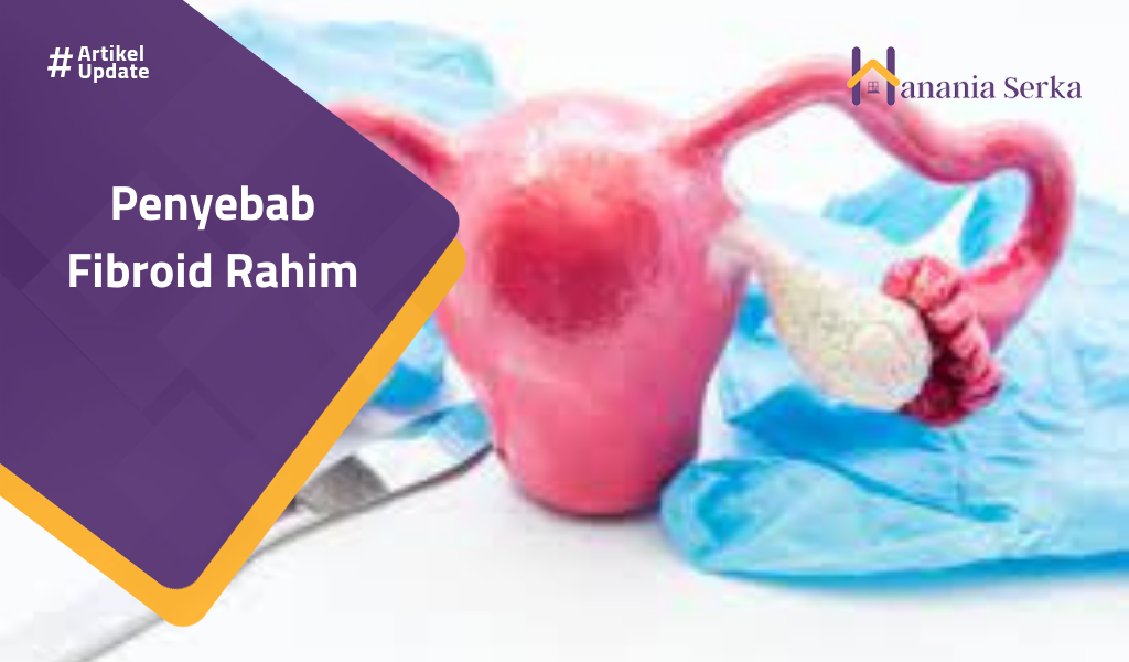 Read more about the article Penyebab Fibroid Rahim