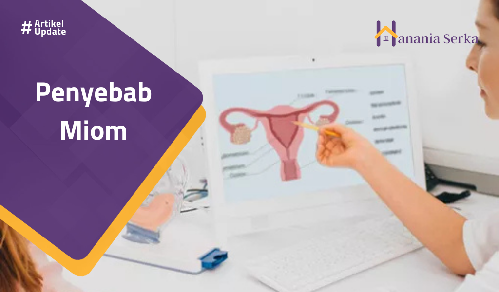 Read more about the article Penyebab Miom