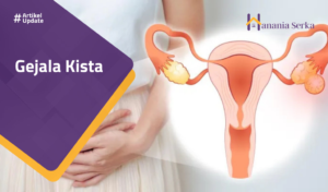 Read more about the article Gejala Kista