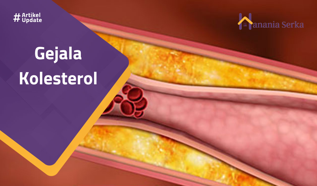 You are currently viewing Gejala Kolesterol