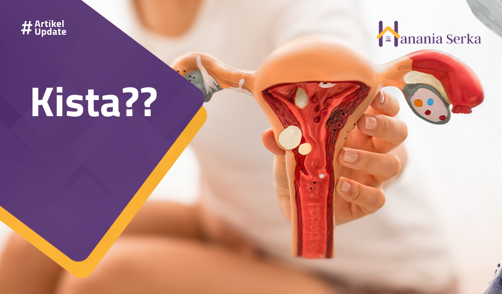 You are currently viewing Kista??