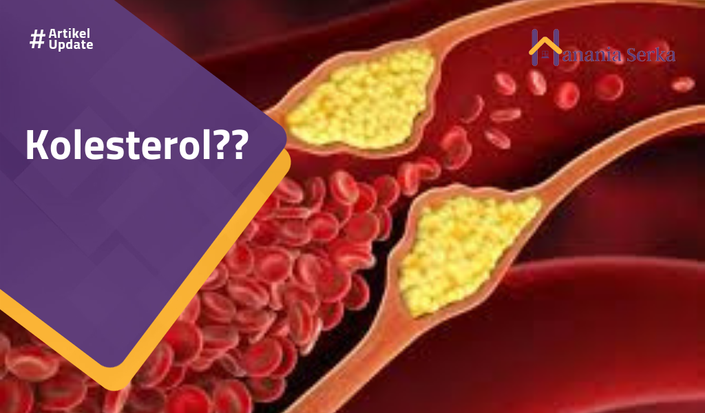 You are currently viewing Kolesterol??