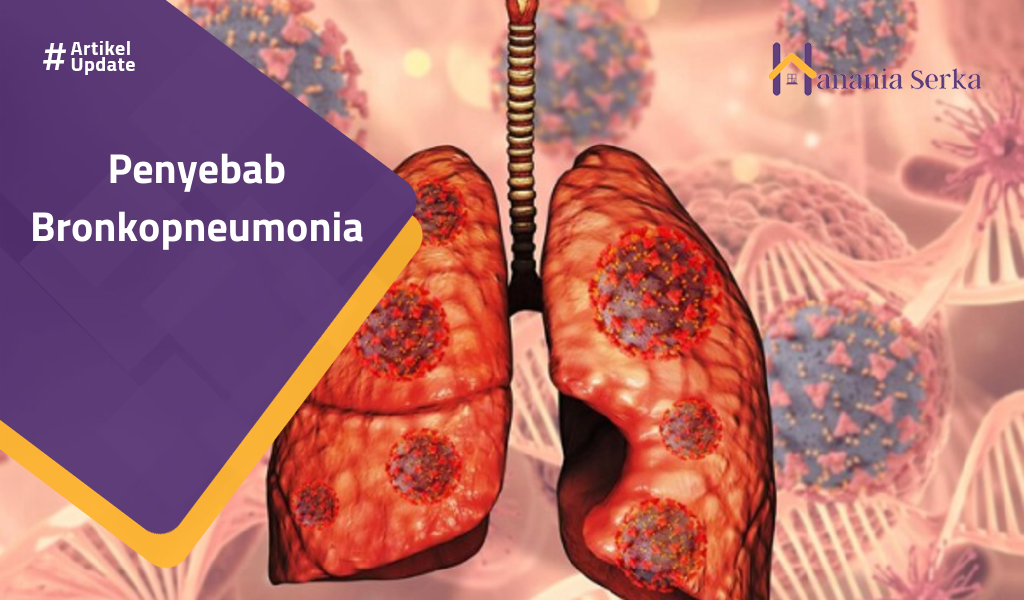 You are currently viewing Penyebab Bronkopneumonia
