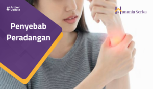 Read more about the article Penyebab Peradangan