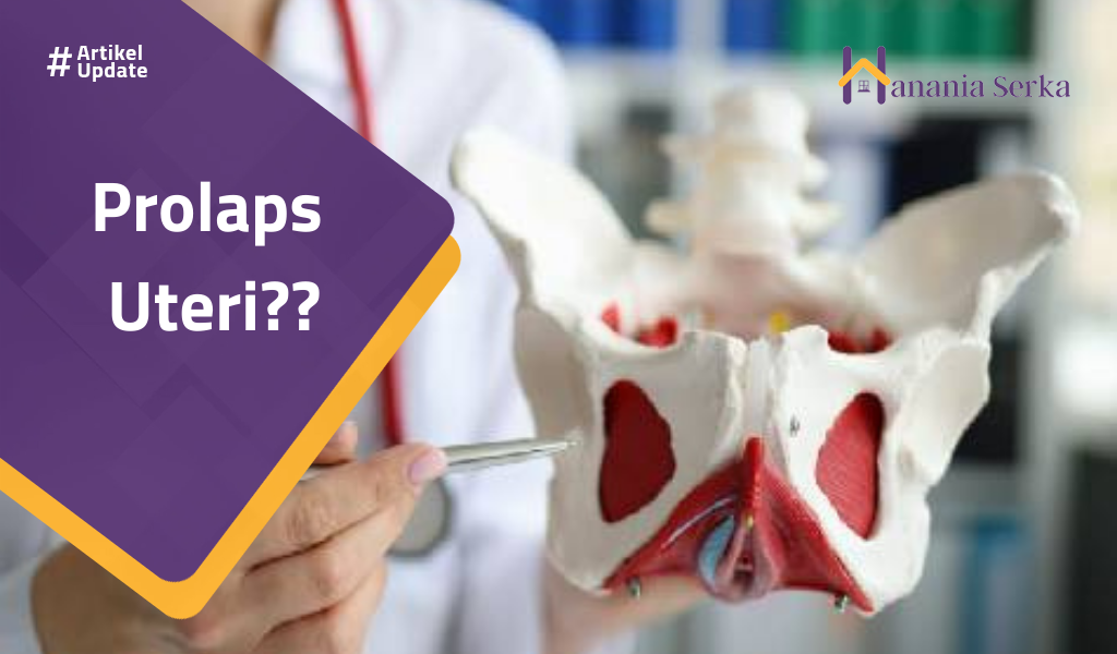 You are currently viewing Prolaps Uteri??