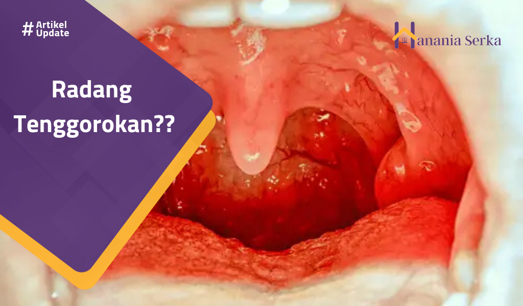 Read more about the article Radang Tenggorokan??