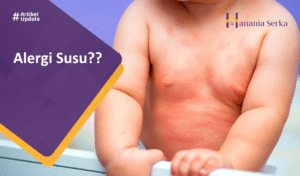 Read more about the article Alergi Susu??