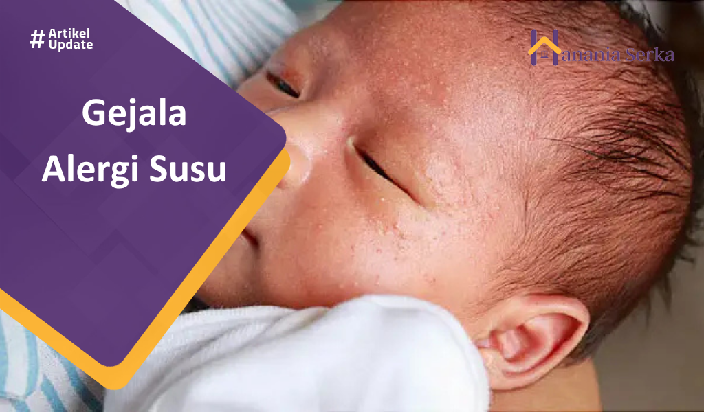 You are currently viewing Gejala Alergi Susu