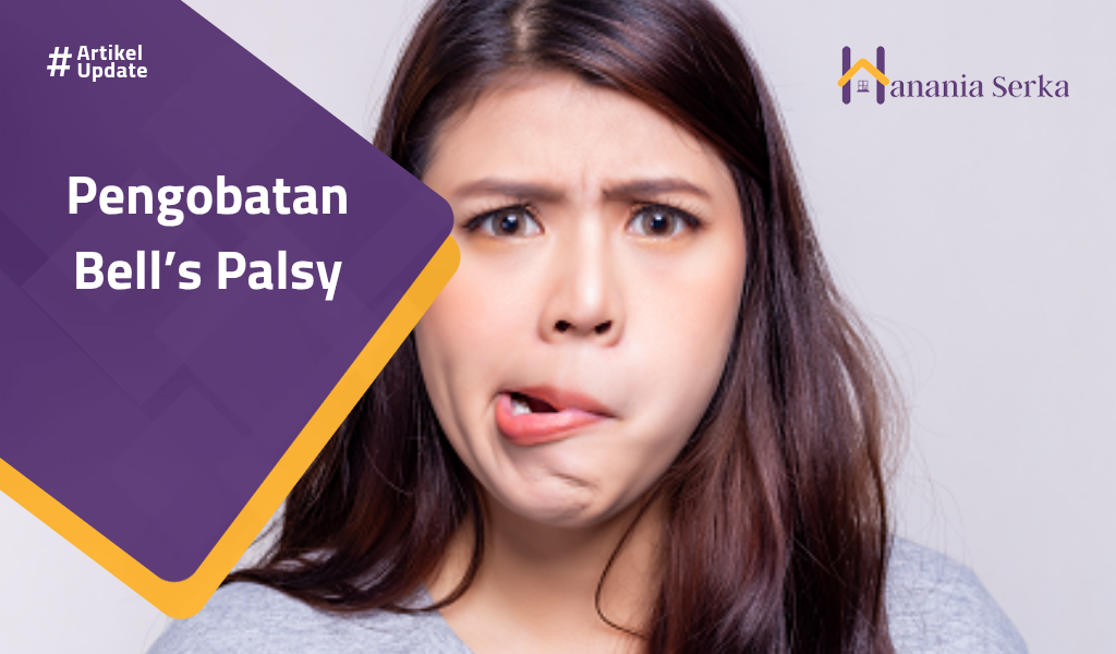 Read more about the article Pengobatan Bell’s Palsy